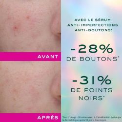 Nuxe Zinc Power Sérum Anti-imperfections
