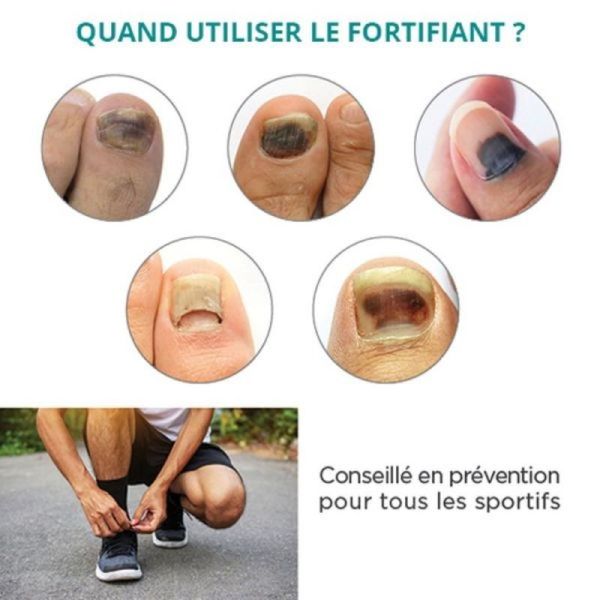Sport Sérum Fortifiant Réparateur Ongles Noirs - 8ml