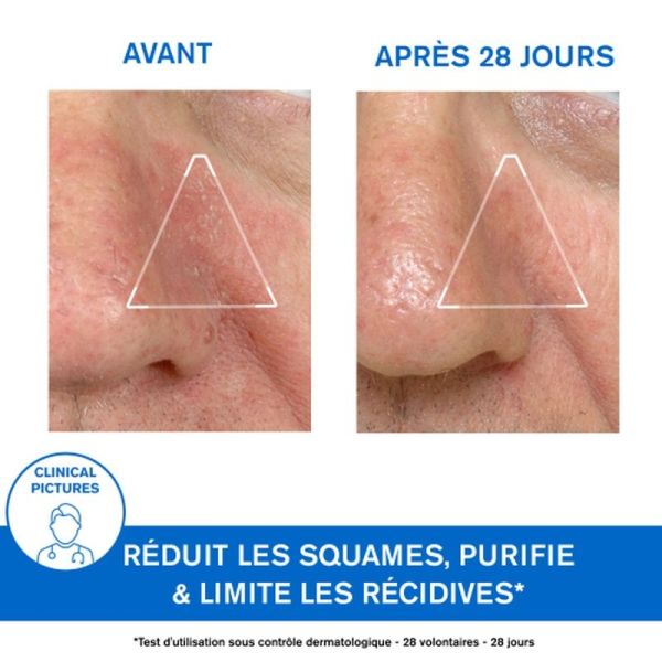 Shampoings & soins capillaires DS - Émulsion Apaisante Régulatrice - 40 mL