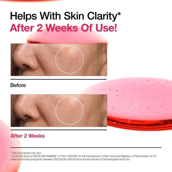 Niacinamide 10% + TXA 4% Serum - 30ml
