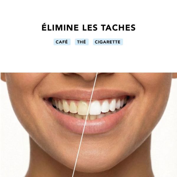 Bandes de blanchiment dentaire - 42 bandes