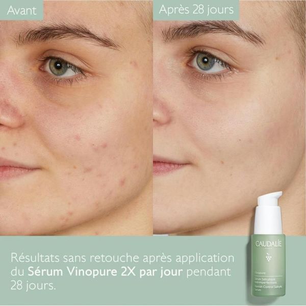 Vinopure Sérum à l'Acide Salicylique Anti-imperfections
