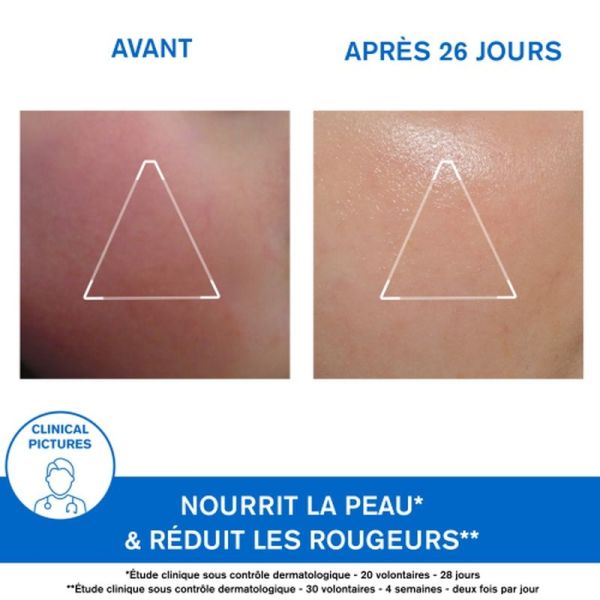 Peaux sèches, tendance à l'eczéma atopique Crème Visage - 40 mL