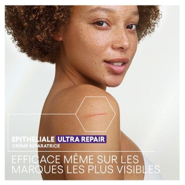 Epitheliale Ultra Repair Crème Réparatrice Anti-Marques - 100ml
