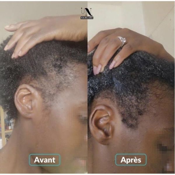 Cure pousse de cheveux - 60 gélules