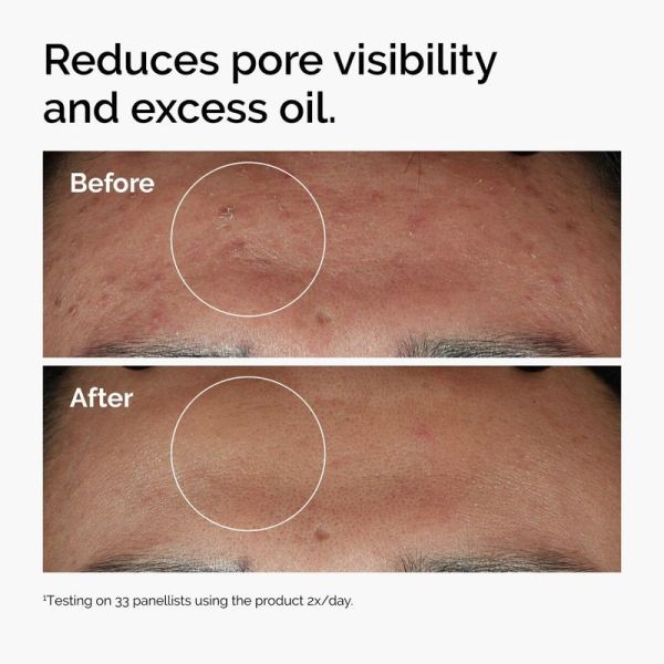 Niacinamide 10% + Zinc 1% - 60ml