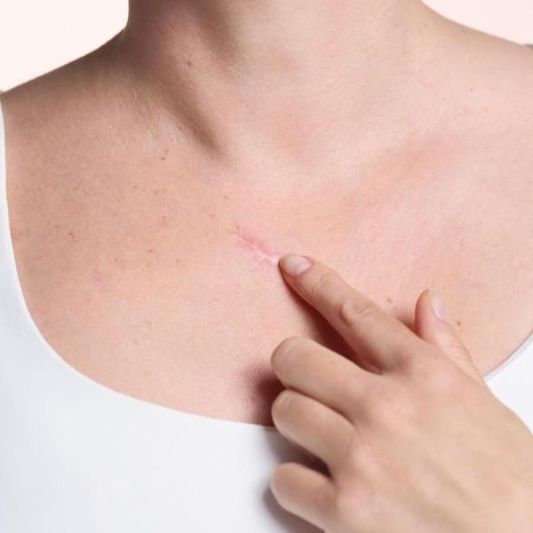 Gel cicatrice Cicalfate+ - 30ml