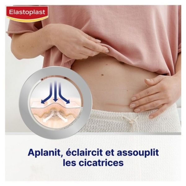 Pansements réducteurs de cicatrices - 21 unités
