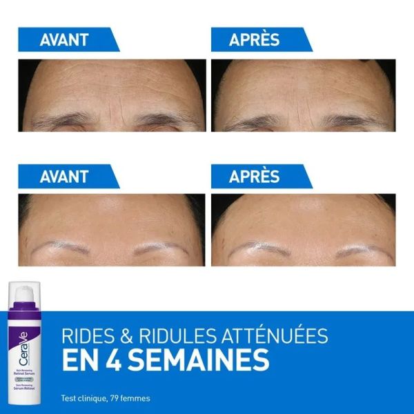 Skin Renewing Sérum Rétinol - 30 ml