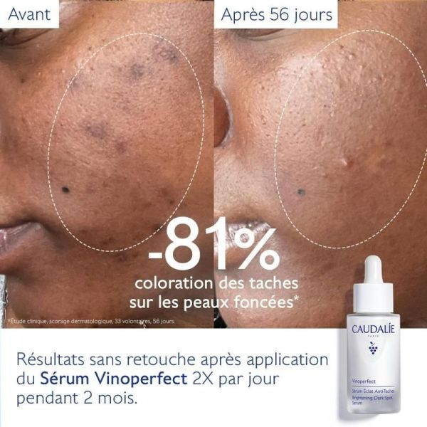 Vinoperfect Sérum Éclat Anti-Taches