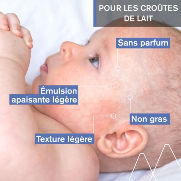 Croûtes de lait BÉBÉ 1ER SOIN CROÛTES DE LAIT - 40 mL