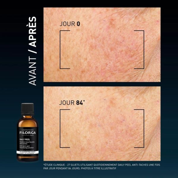 DAILY PEEL - 50 ml