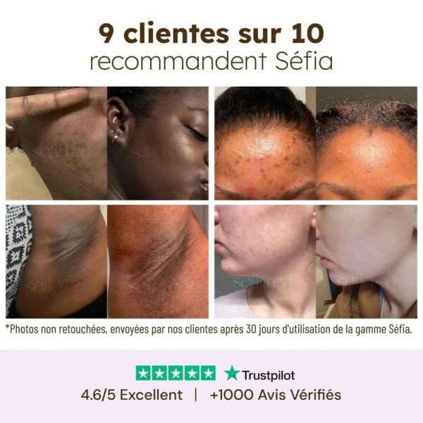 Nettoyant Éclat au Curcuma - 100 ml