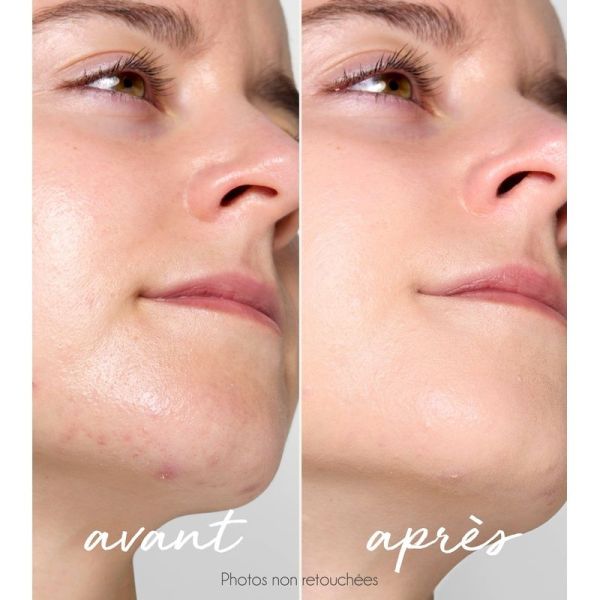 Stick correcteur teinté anti-imperfections rechargeable - 5g