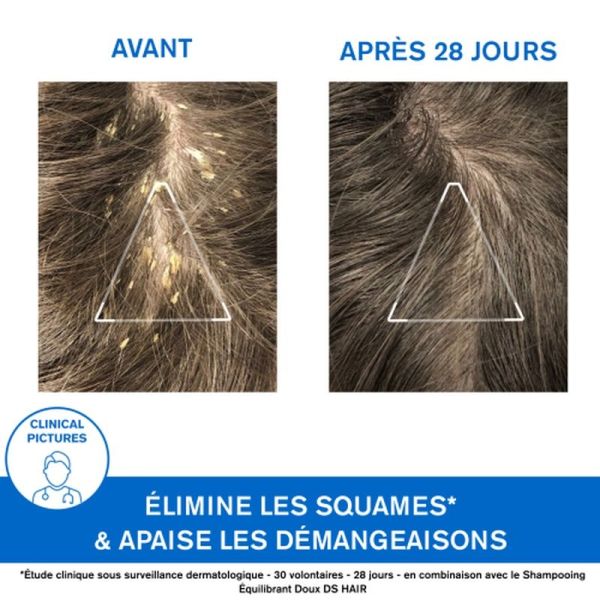Peaux sèches, tendance à l'eczéma atopique KÉRATOSANE 30 Gel-Crème - 75mL