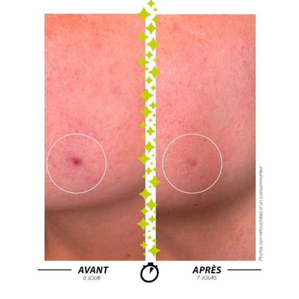 L'ELIXIR DU MARABOUT Sérum concentré Anti-Imperfections, Anti-Âge - 15 ml