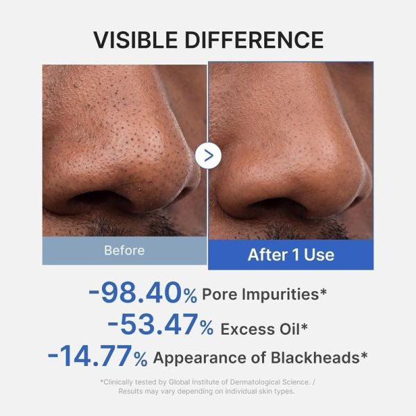 Zero Pore Blackhead Mud Mask - 100 g