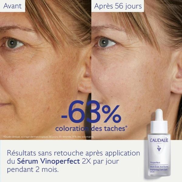 Vinoperfect Sérum Éclat Anti-Taches