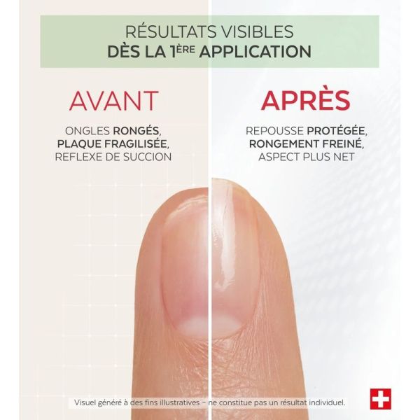 Poderm Nail Corrector - Vernis Amer - 8ml