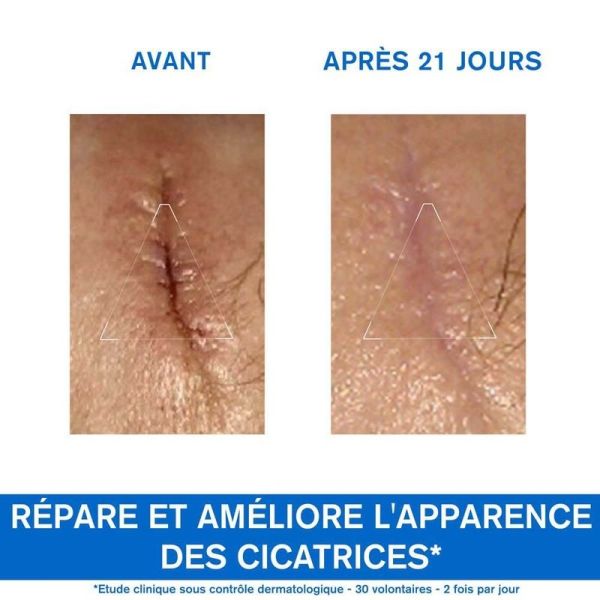 Bariéderm CICA+ Crème Réparatrice  - Marques Cicatricielles - 100 ml