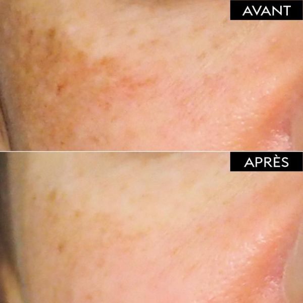 Anti-taches Perfect Routine jour anti-taches - 30ml + 40ml