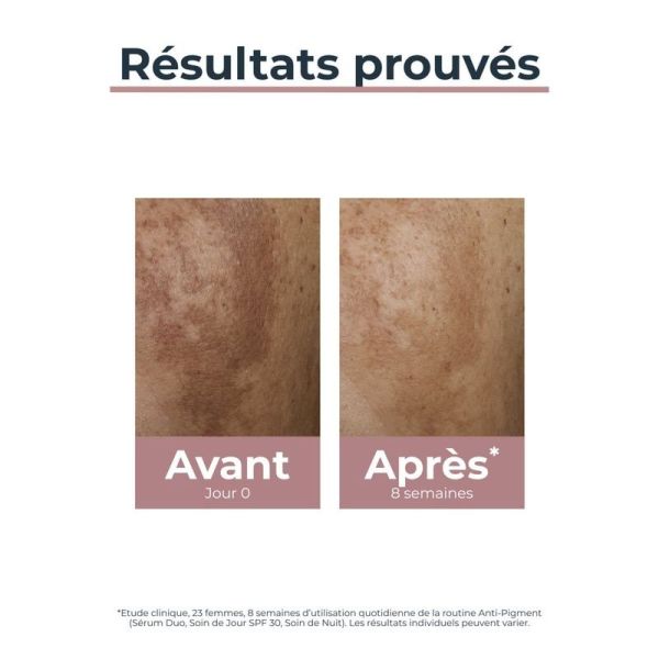 Anti-Pigment Soin de Jour SPF 30
