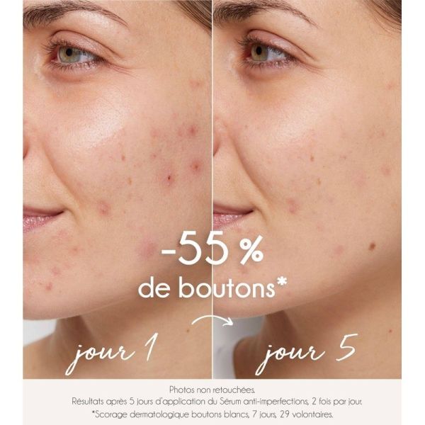 Sérum purifiant anti-imperfections - 30 mL