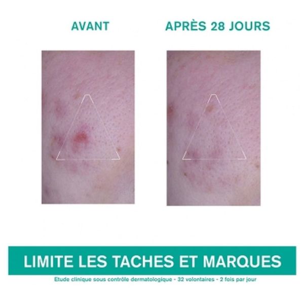 Hyseac 3-Regul+ - 40ml