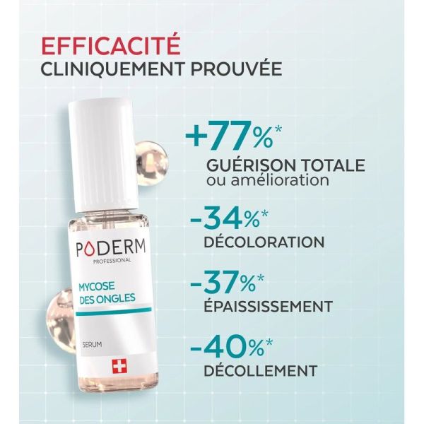 Duo express - Mycose des ongles