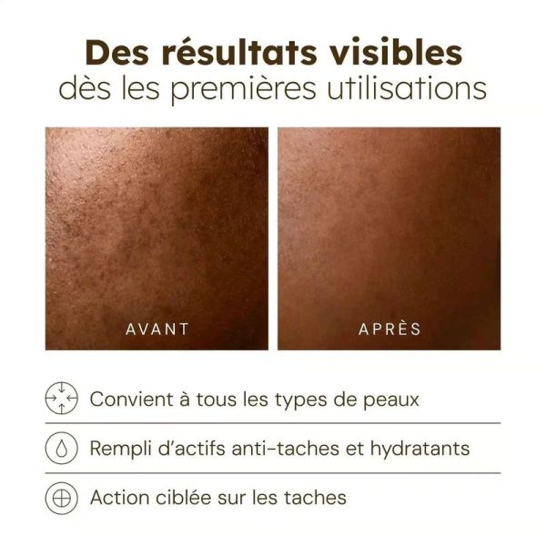 Sérum Éclat Anti-Taches - 30ml