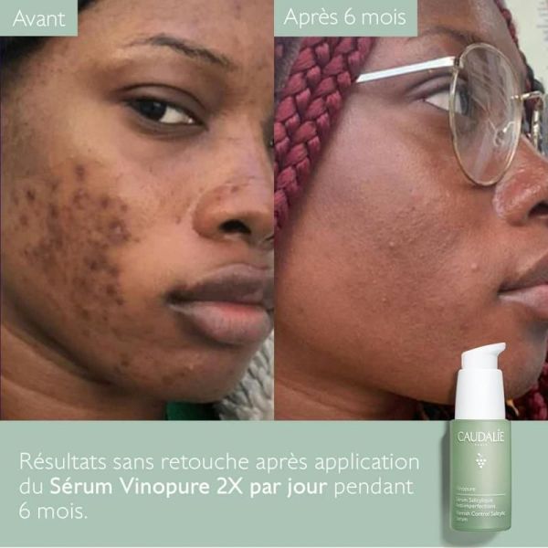 Vinopure Sérum à l'Acide Salicylique Anti-imperfections