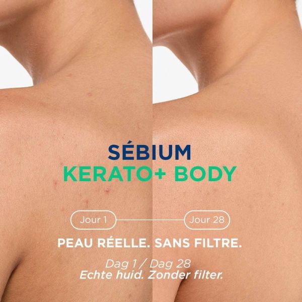 Sébium Kerato+ Body - Spray Anti-Imperfections Apaisant - Corps - Peaux à Tendance Acnéique - 150ml