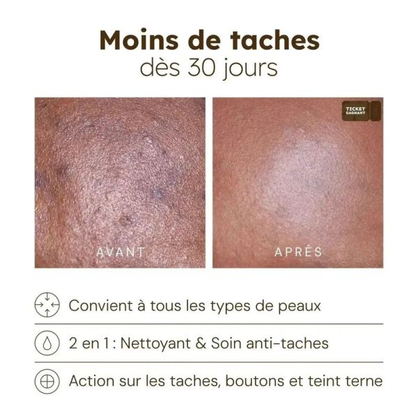 Cotons Anti-Imperfections - 30 cotons