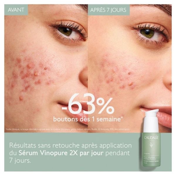 Sérum à l'Acide Salicylique Anti-imperfections Vinopure - 30 ml