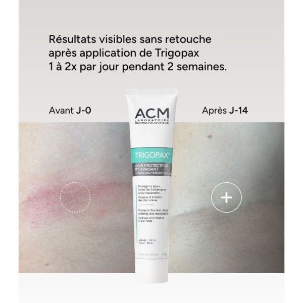 Trigopax Soin Protecteur et Apaisant - 30 ml