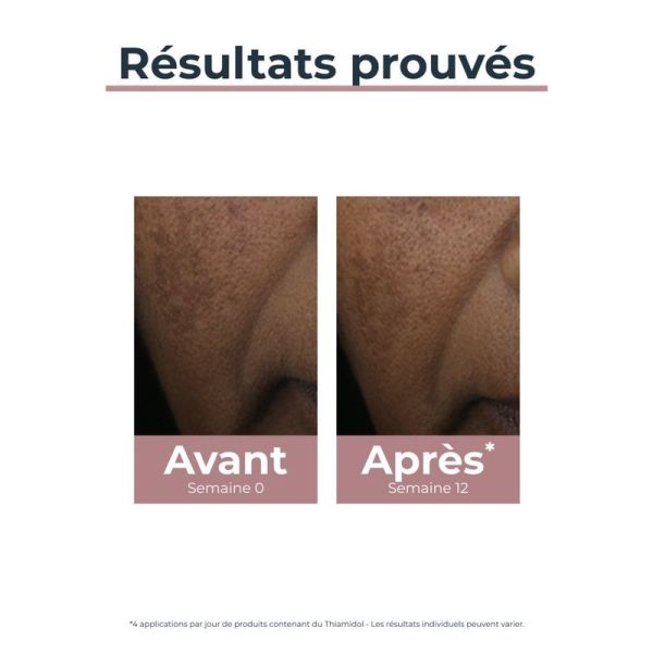 Anti-Pigment Correcteur de taches