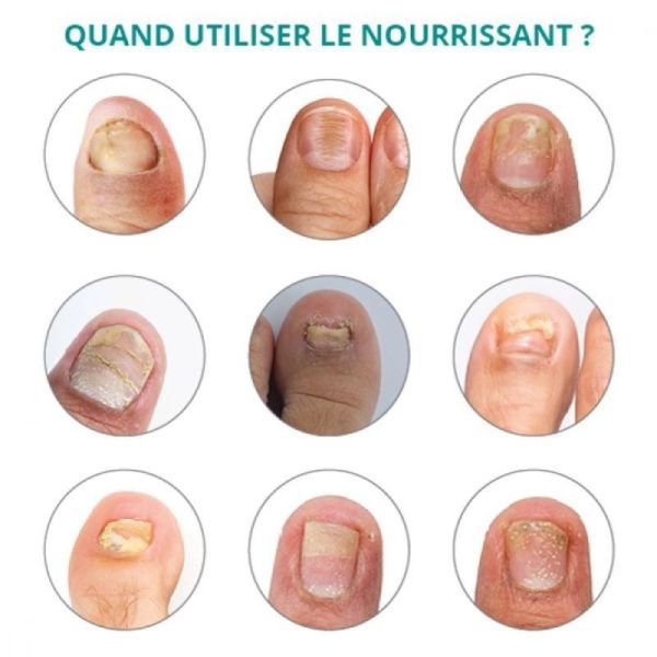 Professional Huile Sérum Nourrissante - 8ml