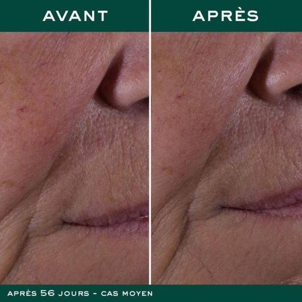 Anti-Âge Global - 50ml