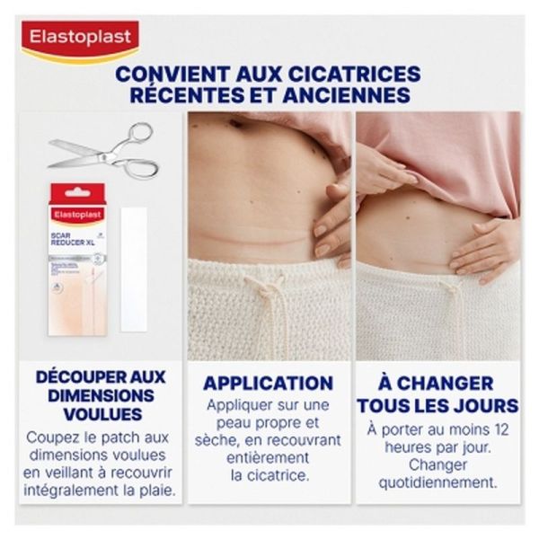 Pansements réducteurs de cicatrices - 21 unités