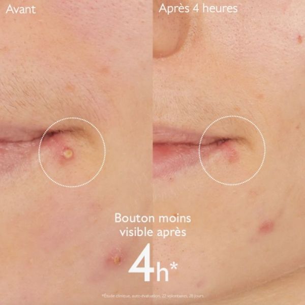 Vinopure Stop Bouton - 15ml