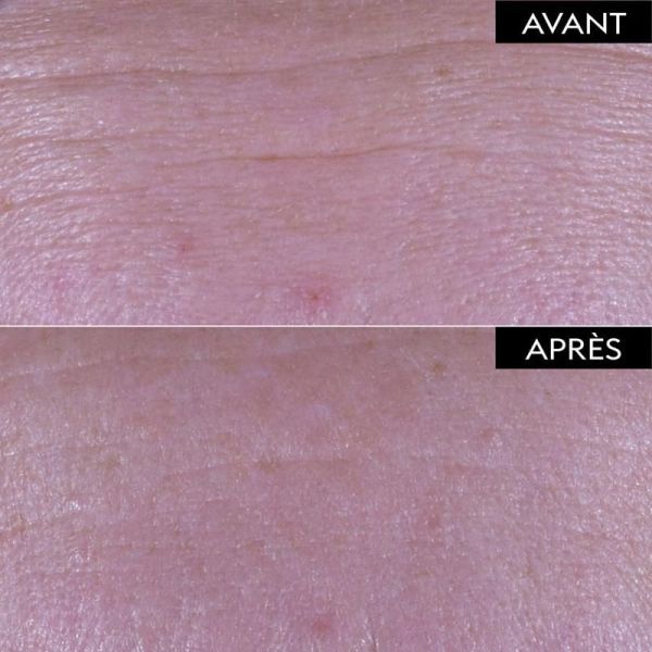 Age Specific Intensif Sérum Repulpant Fondamental - 30 ml