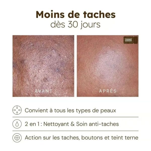 Cotons Anti-Imperfections - 30 cotons