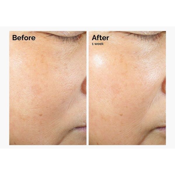 Microémulsion de Lipides de Riz + Ectoïne - 60 ml