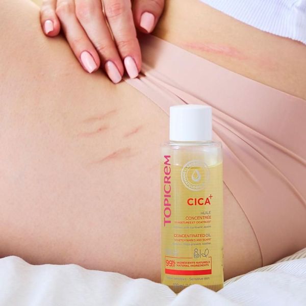 CICA+ Huile concentrée vergetures et cicatrices - 100 ML
