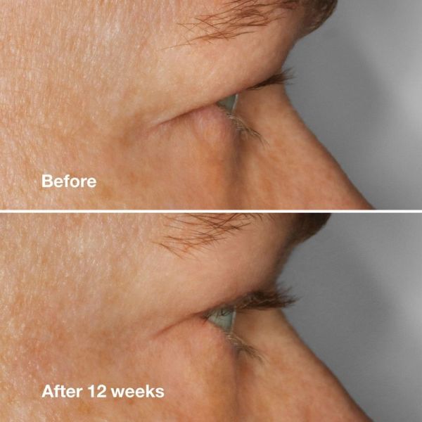 High Impact Serum Cils - 3ml