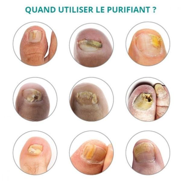 Huile Sérum Purifiante - 8ml