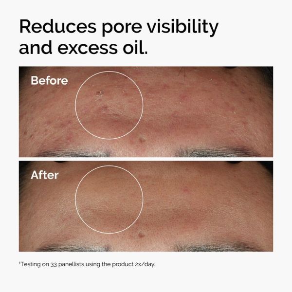 Niacinamide 10% + Zinc 1% - 30ml