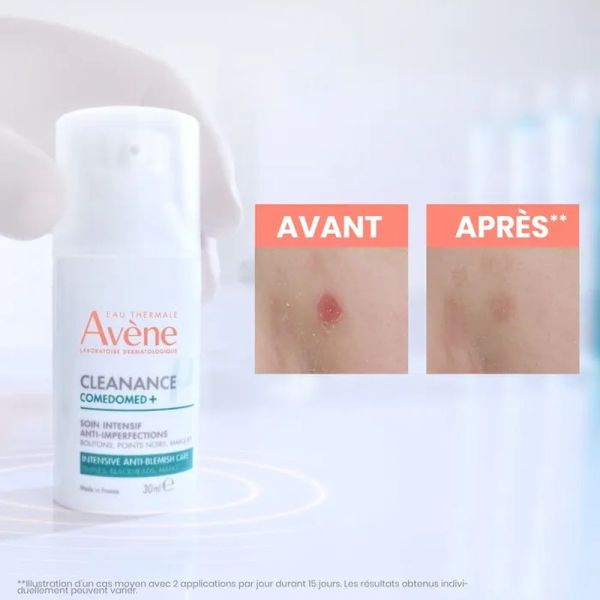 Comedomed+ Soin Intensif Anti-Imperfections Cleanance - 30 ml
