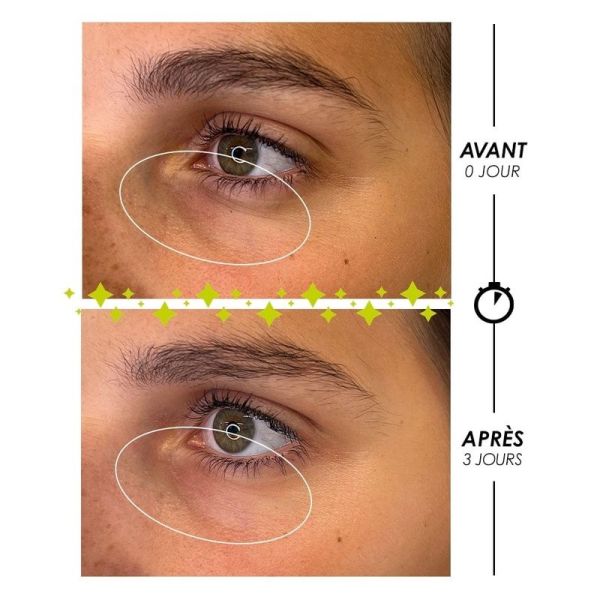 [ LARMES de FANTÔME ] Roll-On Multi-Actions Paupières et Yeux - 10 ml