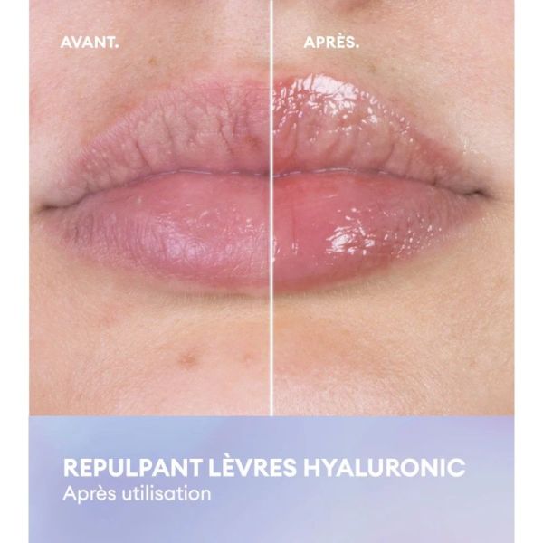 Patyka Repulpant Lèvres Hyaluronic - 7ml